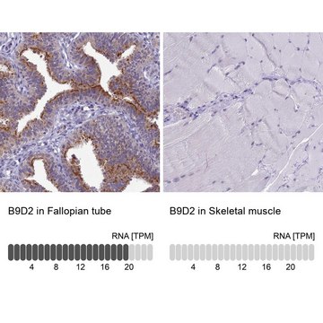 Anti-B9D2 antibody produced in rabbit Prestige Antibodies&#174; Powered by Atlas Antibodies, affinity isolated antibody, buffered aqueous glycerol solution