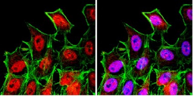 Anti-FOXO3A Antibody from rabbit, purified by affinity chromatography