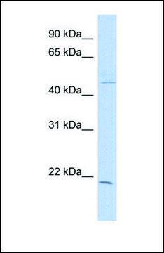 Anti-CIB3, (N-terminal) antibody produced in rabbit affinity isolated antibody