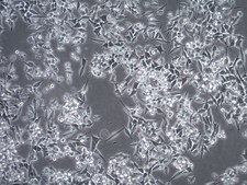 Assay Ready MB49 Mouse Bladder Carcinoma Cell Line