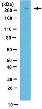 Anti-LRRK2 Antibody from rabbit, purified by affinity chromatography