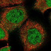 Anti-ZBTB48 antibody produced in rabbit Prestige Antibodies® Powered by Atlas Antibodies, affinity isolated antibody, buffered aqueous glycerol solution