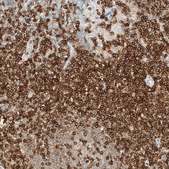 Monoclonal Anti-CD5 antibody produced in mouse Prestige Antibodies® Powered by Atlas Antibodies, clone CL12420, purified immunoglobulin, buffered aqueous glycerol solution