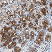 Anti-ADAP1 antibody produced in rabbit Prestige Antibodies® Powered by Atlas Antibodies, affinity isolated antibody, buffered aqueous glycerol solution