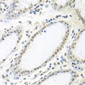 Anti-HuR/ELAVL1 antibody produced in rabbit