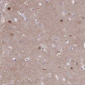 Anti-PGM2L1 antibody produced in rabbit Prestige Antibodies® Powered by Atlas Antibodies, affinity isolated antibody, buffered aqueous glycerol solution