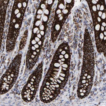 Anti-MRPL12 antibody produced in rabbit Prestige Antibodies&#174; Powered by Atlas Antibodies, affinity isolated antibody, buffered aqueous glycerol solution, Ab1