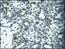 Anti-SMARCB1 antibody produced in rabbit affinity isolated antibody