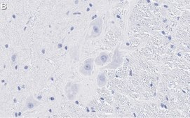 Anti-MRGPRX4 Antibody, clone 3F4 ZooMAb® Rabbit Monoclonal recombinant, expressed in HEK 293 cells