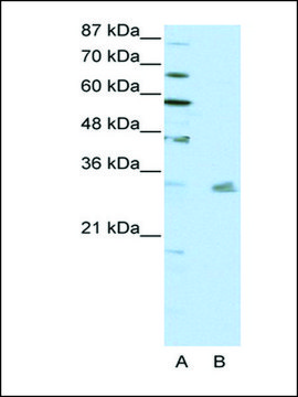 Anti-PITX3 antibody produced in rabbit affinity isolated antibody