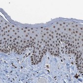 Anti-PHF2 antibody produced in rabbit Prestige Antibodies® Powered by Atlas Antibodies, affinity isolated antibody, buffered aqueous glycerol solution