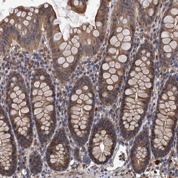 Anti-LRRC2 antibody produced in rabbit Prestige Antibodies&#174; Powered by Atlas Antibodies, affinity isolated antibody, buffered aqueous glycerol solution