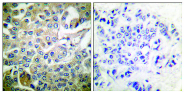 Anti-RAC1 antibody produced in rabbit affinity isolated antibody