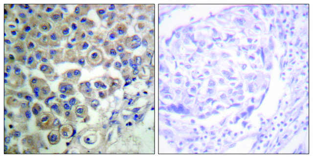 Anti-PLC &#946;3 antibody produced in rabbit affinity isolated antibody