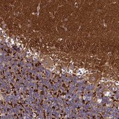 Anti-DMXL2 antibody produced in rabbit Prestige Antibodies® Powered by Atlas Antibodies, affinity isolated antibody, buffered aqueous glycerol solution