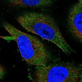 Anti-METTL13 antibody produced in rabbit Prestige Antibodies® Powered by Atlas Antibodies, affinity isolated antibody, buffered aqueous glycerol solution