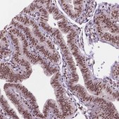 Anti-UBN1 antibody produced in rabbit Prestige Antibodies® Powered by Atlas Antibodies, affinity isolated antibody, buffered aqueous glycerol solution