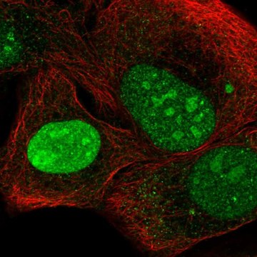 Anti-NEPRO antibody produced in rabbit Prestige Antibodies&#174; Powered by Atlas Antibodies, affinity isolated antibody