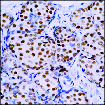 Anti-Estrogen Receptor antibody, Rabbit monoclonal clone SP1, recombinant, expressed in proprietary host, tissue culture supernatant