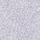 Anti-SLC11A1 antibody produced in rabbit Prestige Antibodies® Powered by Atlas Antibodies, affinity isolated antibody, buffered aqueous glycerol solution