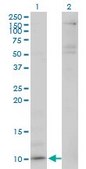 Monoclonal Anti-CXCL5 antibody produced in mouse clone M1, purified immunoglobulin, buffered aqueous solution