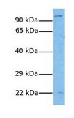 Anti-PPARGC1A affinity isolated antibody