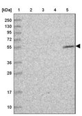 Anti-UTP4 antibody produced in rabbit Prestige Antibodies® Powered by Atlas Antibodies, affinity isolated antibody, buffered aqueous glycerol solution
