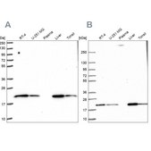 Anti-MT-CO2 antibody produced in rabbit Prestige Antibodies® Powered by Atlas Antibodies, affinity isolated antibody, buffered aqueous glycerol solution