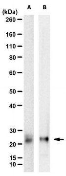 Anti-LRAT Antibody, clone 49569