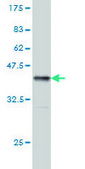Monoclonal Anti-TPP1 antibody produced in mouse clone 3B1, purified immunoglobulin, buffered aqueous solution