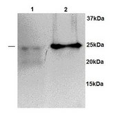 Anti-TPI1 antibody produced in rabbit affinity isolated antibody