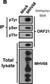 Anti-Phosphoserine Antibody Chemicon&#174;, from rabbit