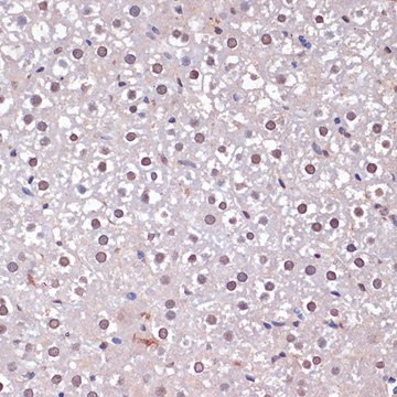 Anti-CDKN2A/p16INK4a antibody produced in rabbit