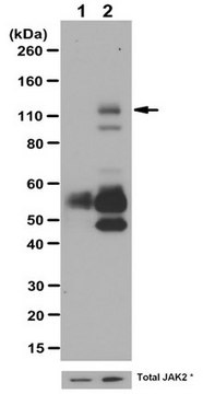 抗磷酸-JAK2（Tyr1007/1008）抗体 from rabbit, purified by affinity chromatography