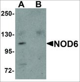 Anti-NOD6 antibody produced in rabbit affinity isolated antibody, buffered aqueous solution
