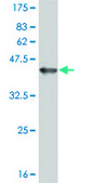 Monoclonal Anti-ERN1 antibody produced in mouse clone 3D1, purified immunoglobulin, buffered aqueous solution