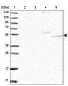 Anti-RMDN2 antibody produced in rabbit Prestige Antibodies® Powered by Atlas Antibodies, affinity isolated antibody, buffered aqueous glycerol solution