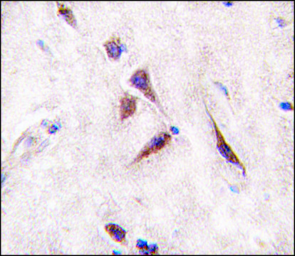 Anti-ALDH6A1 (C-term) antibody produced in rabbit affinity isolated antibody, buffered aqueous solution