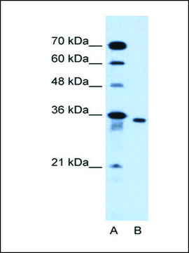 Anti-SLC25A32 affinity isolated antibody