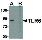Anti-TLR6 (ab1) antibody produced in rabbit affinity isolated antibody, buffered aqueous solution