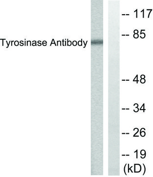 Anti-Tyrosinase antibody produced in rabbit affinity isolated antibody