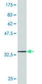 Monoclonal Anti-MVK, (C-terminal) antibody produced in mouse clone 2C5, purified immunoglobulin, buffered aqueous solution