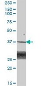 Anti-BLVRA antibody produced in mouse purified immunoglobulin, buffered aqueous solution