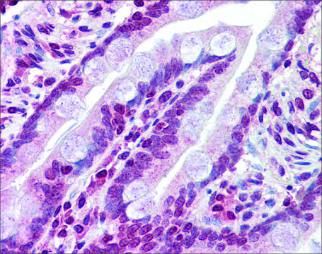 Anti-ABCC8 antibody produced in rabbit affinity isolated antibody