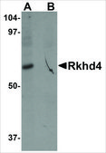 抗RKHD4 兔抗 affinity isolated antibody, buffered aqueous solution