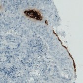 Monoclonal Anti-RNASE7 antibody produced in mouse Prestige Antibodies® Powered by Atlas Antibodies, clone CL0223, purified immunoglobulin, buffered aqueous glycerol solution