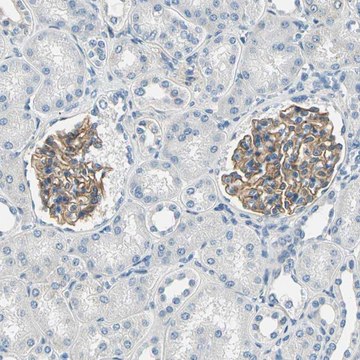 Anti-TGFBR3 antibody produced in rabbit Prestige Antibodies&#174; Powered by Atlas Antibodies, affinity isolated antibody, buffered aqueous glycerol solution