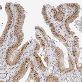 Anti-TOX4 antibody produced in rabbit Prestige Antibodies® Powered by Atlas Antibodies, affinity isolated antibody, buffered aqueous glycerol solution