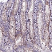 Anti-TMEM171 antibody produced in rabbit Prestige Antibodies® Powered by Atlas Antibodies, affinity isolated antibody, buffered aqueous glycerol solution