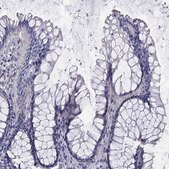 Anti-ANXA10 antibody produced in rabbit Prestige Antibodies® Powered by Atlas Antibodies, affinity isolated antibody, buffered aqueous glycerol solution